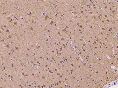 Immunohistochemistry-Paraffin: EFCBP2 Antibody [NBP2-97439]
