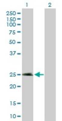 Western Blot: EFCBP2 Antibody [H00054550-B01P]