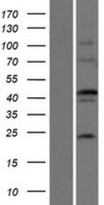 Western Blot: EFCBP2 Overexpression Lysate [NBP2-06727]