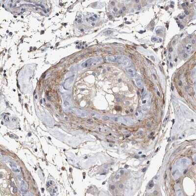 Immunohistochemistry-Paraffin: EFEMP2 Antibody [NBP1-84724]