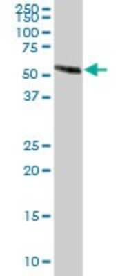 Western Blot: EFEMP2 Antibody [H00030008-B01P]