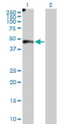 Western Blot: EFEMP2 Antibody [H00030008-D01P]