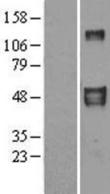 Western Blot: EFEMP2 Overexpression Lysate [NBL1-10136]