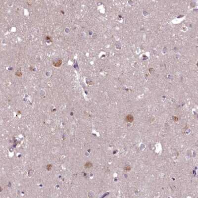 Immunohistochemistry-Paraffin: EFHA1 Antibody [NBP1-91864]