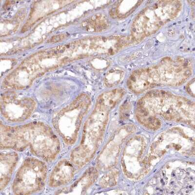 Immunohistochemistry-Paraffin: EFHA1 Antibody [NBP1-91864]