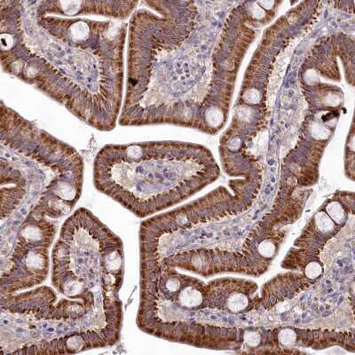 Immunohistochemistry-Paraffin: EFHA1 Antibody [NBP1-91864]