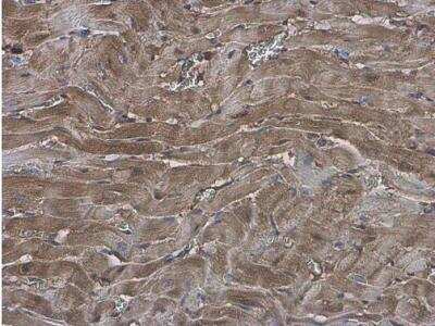 Immunohistochemistry-Paraffin: EFHA1 Antibody [NBP2-16278]