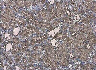 Immunohistochemistry-Paraffin: EFHA1 Antibody [NBP2-16278]