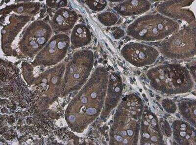 Immunohistochemistry-Paraffin: EFHA1 Antibody [NBP2-16278]