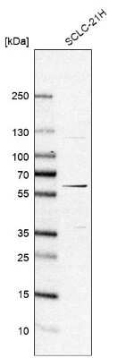 Western Blot: EFHA2 Antibody [NBP1-85154]