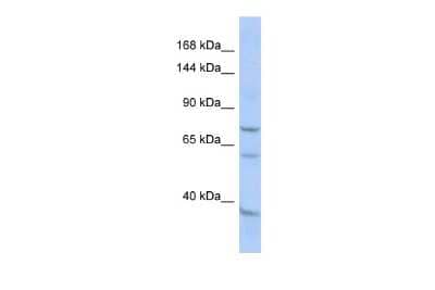 Western Blot: EFHB Antibody [NBP2-82976]