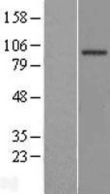 Western Blot: EFHB Overexpression Lysate [NBL1-10138]