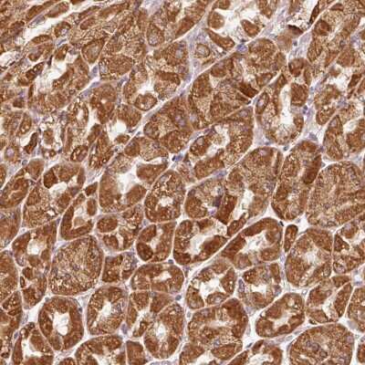 Immunohistochemistry: EFHC1 Antibody [NBP2-38245]