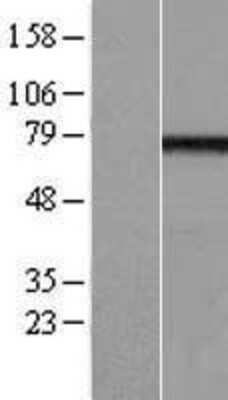 Western Blot: EFHC1 Overexpression Lysate [NBL1-10139]