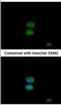 Immunocytochemistry/ Immunofluorescence: EFHC2 Antibody [NBP2-16279]