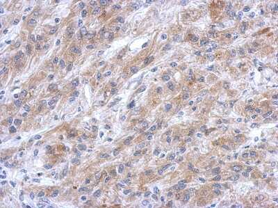 Immunohistochemistry-Paraffin: EFHC2 Antibody [NBP2-16279]