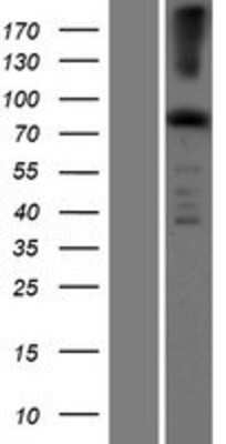 Western Blot: EFHC2 Overexpression Lysate [NBP2-06231]