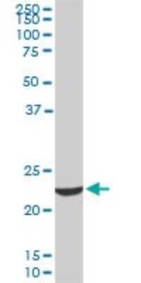 Western Blot: EFHD1 Antibody (1A8) [H00080303-M09]