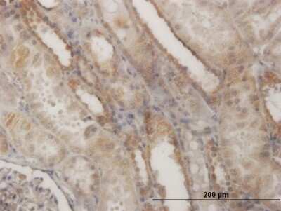 Immunohistochemistry-Paraffin: EFHD1 Antibody (1H7) [H00080303-M05]