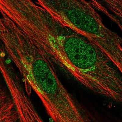 Immunocytochemistry/ Immunofluorescence: EFHD1 Antibody [NBP2-33808]