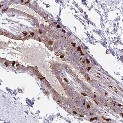 Immunohistochemistry-Paraffin: EFHD1 Antibody [NBP2-33808]