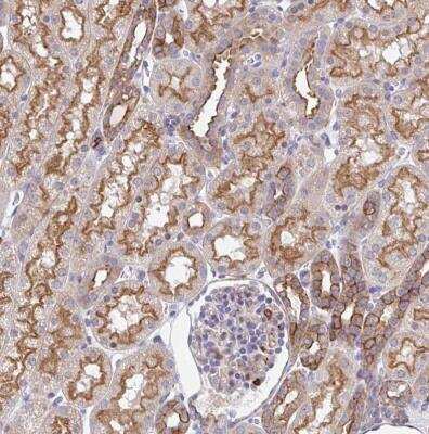 Immunohistochemistry-Paraffin: EFHD1 Antibody [NBP2-33808]