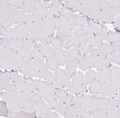 Immunohistochemistry-Paraffin: EFHD1 Antibody [NBP2-33808]
