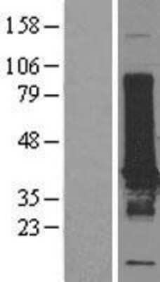 Western Blot: EFHD1 Overexpression Lysate [NBL1-10140]