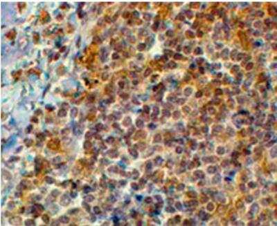 Immunohistochemistry-Paraffin: EFHD2 Antibody [NB100-1477]