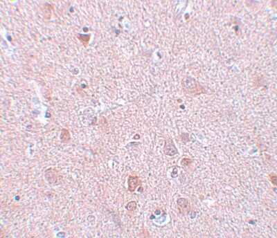 Immunohistochemistry-Paraffin: EFHD2 Antibody - BSA Free [NBP1-77135]