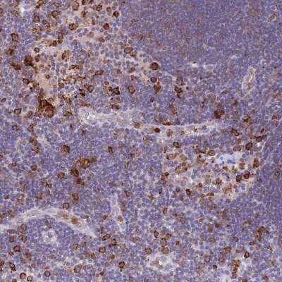 Immunohistochemistry-Paraffin: EFHD2 Antibody [NBP2-13947]