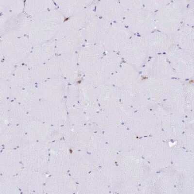 Immunohistochemistry-Paraffin: EFHD2 Antibody [NBP2-13947]