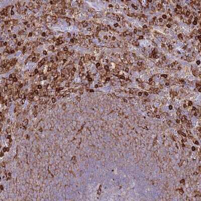 Immunohistochemistry-Paraffin: EFHD2 Antibody [NBP2-13947]