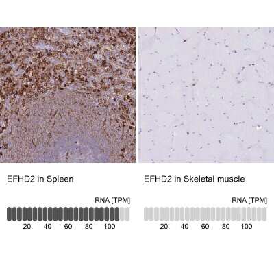 Immunohistochemistry-Paraffin: EFHD2 Antibody [NBP2-13947]