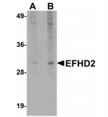 Western Blot: EFHD2 AntibodyBSA Free [NBP1-77135]