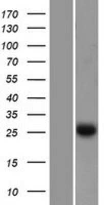 Western Blot: EFHD2 Overexpression Lysate [NBP2-06338]