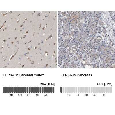 Immunohistochemistry-Paraffin: EFR3A Antibody [NBP1-81538]