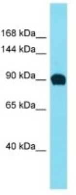 Western Blot: EFR3B Antibody [NBP3-10769]