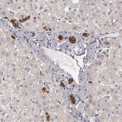 Immunohistochemistry-Paraffin: EFS Antibody [NBP2-31993]