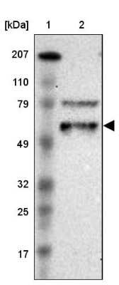 Western Blot: EFS Antibody [NBP2-31993]