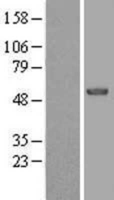 Western Blot: EFS Overexpression Lysate [NBL1-10148]