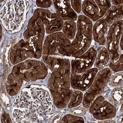 Immunohistochemistry: EFTUD1 Antibody [NBP2-32619]