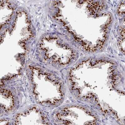 Immunohistochemistry-Paraffin: EFTUD1 Antibody [NBP2-33646]