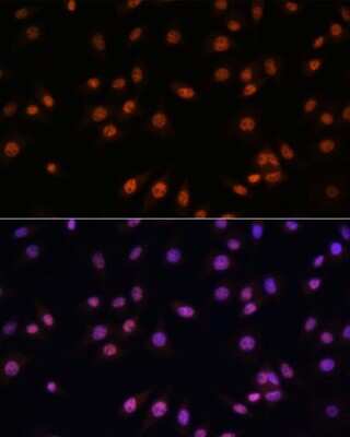 Immunocytochemistry/ Immunofluorescence: EFTUD2 Antibody - BSA Free [NBP2-92930]