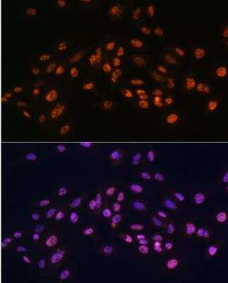 Immunocytochemistry/ Immunofluorescence: EFTUD2 Antibody - BSA Free [NBP2-92930]