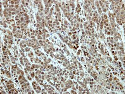 Immunohistochemistry-Paraffin: EFTUD2 Antibody [NBP2-16282]