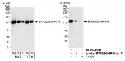 Immunoprecipitation: EFTUD2 Antibody [NB100-40849]