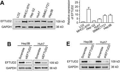 Knockdown Validated: EFTUD2 Antibody [NB100-40849]