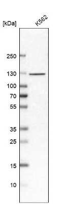 Western Blot: EFTUD2 Antibody [NBP1-87019]