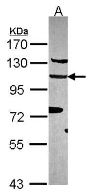 Western Blot: EFTUD2 Antibody [NBP2-16282]